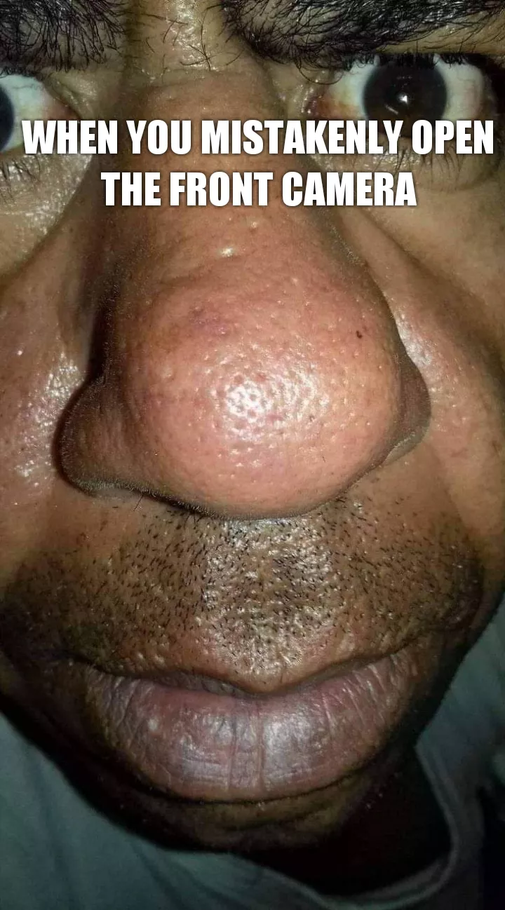 Front camera errors