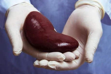 Since everyone is posting.. today I was able to harvest my first organ (kidney) from the homeless person who wandered into my garden. Got a little damaged from all the flailing and kicking, but it&#039;ll do.