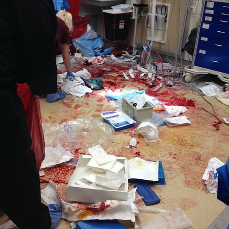 The aftermath of saving a life